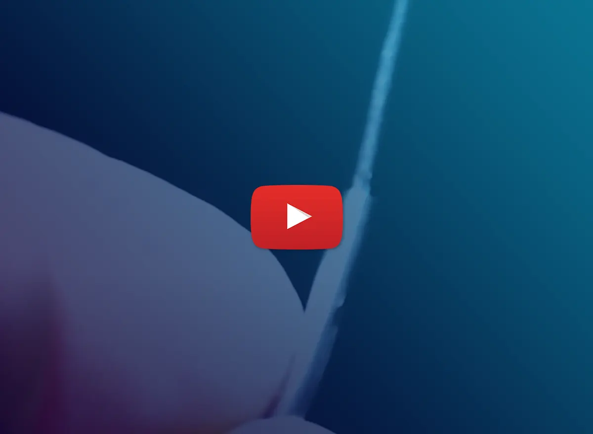 Strong Bimetal Welding with SLTL Laser Welding System